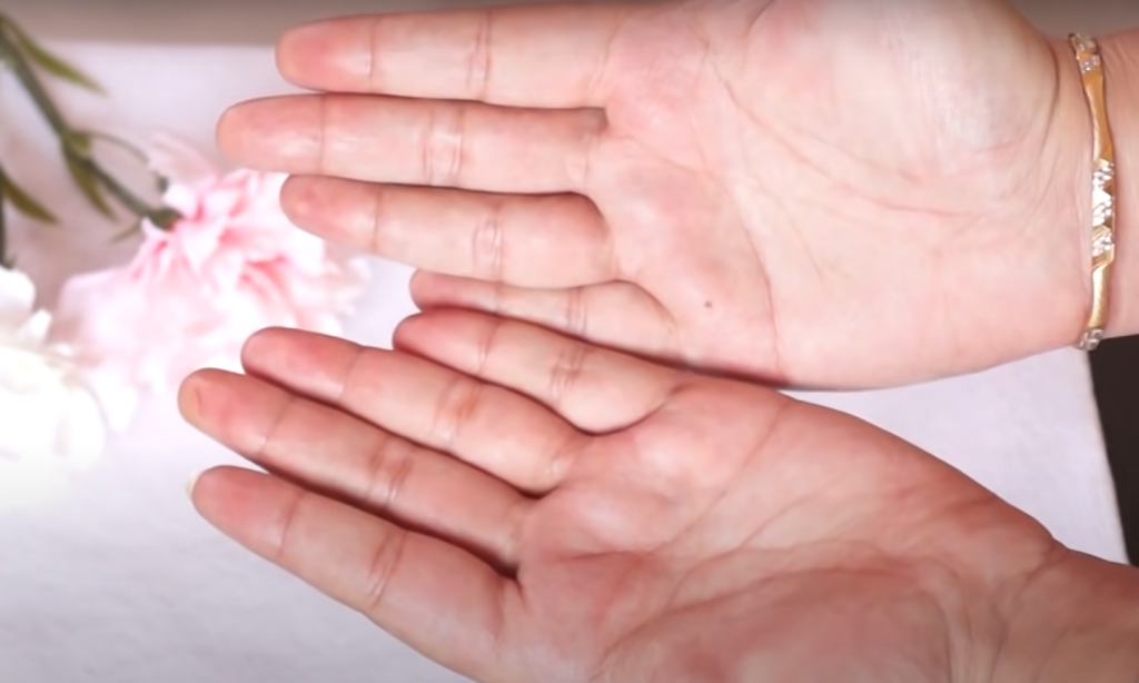 Do sweaty hands mean anxiety?